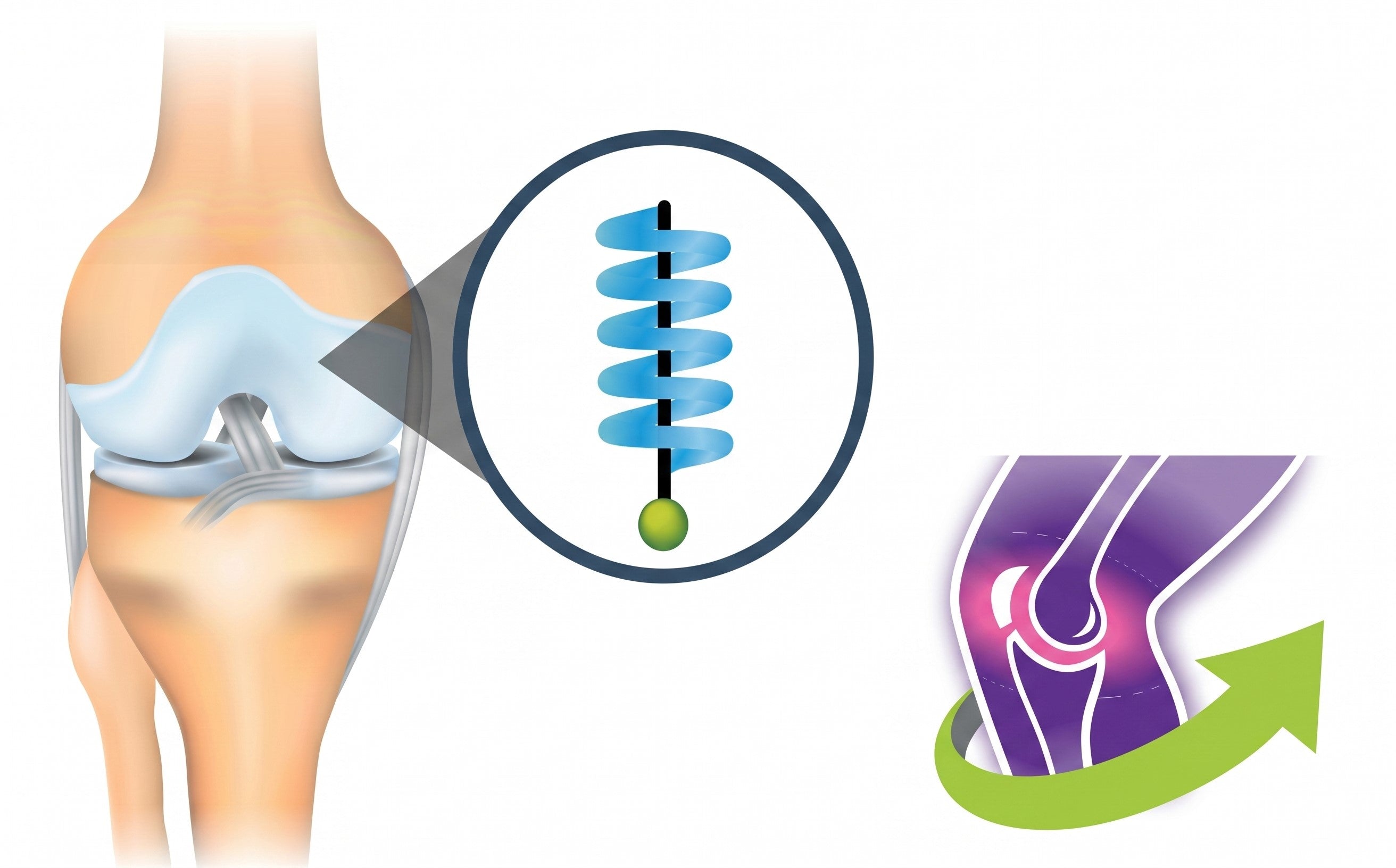 Is Your Joint Health Losing Its "Bounce"? The Secret Role of Proteoglycan.